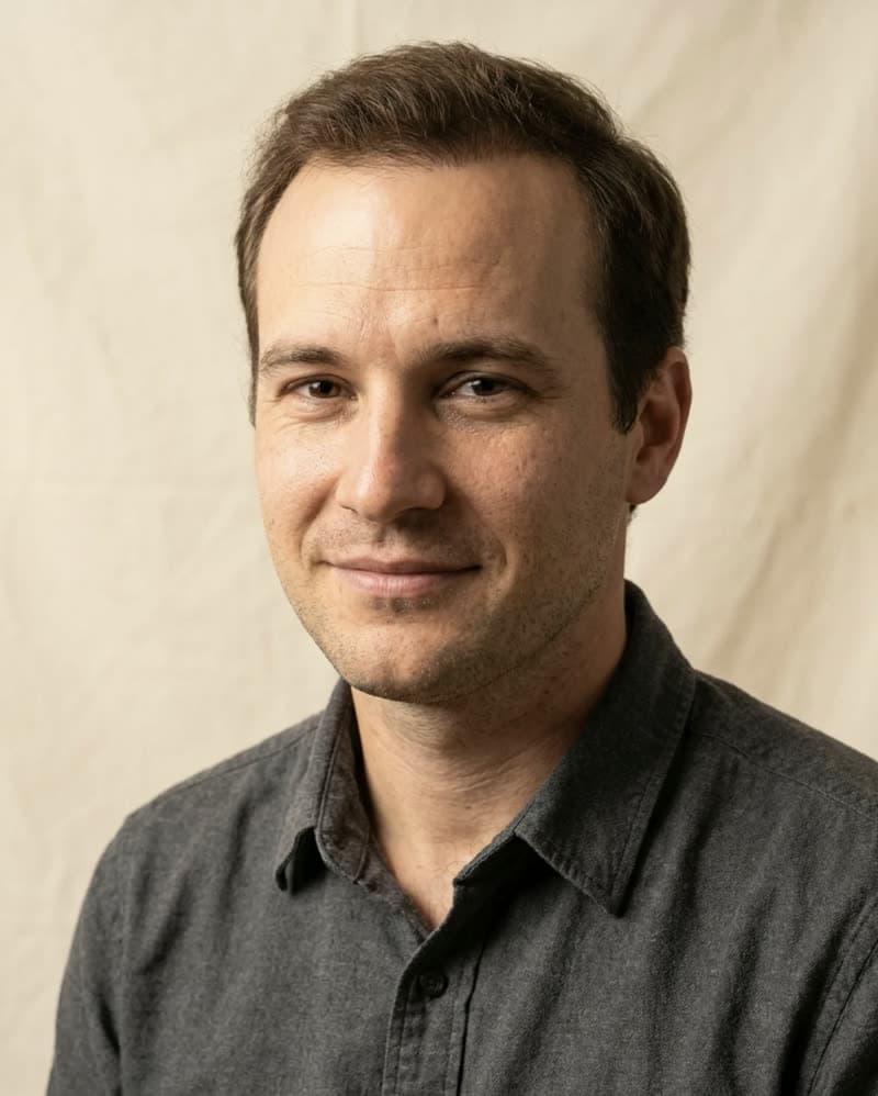 Haartransplantation nachher, Patient 1