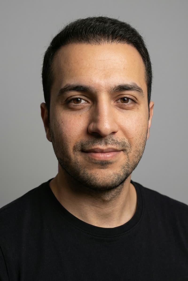 Haartransplantation nachher, Patient 2